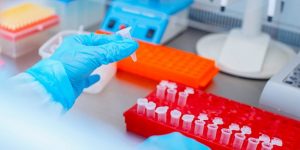 Dna test in the lab. a laboratory technician with a dispenser in his hands